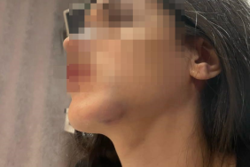 genc-kadini-olduresiye-darp-etti-beni-tuzaga-19290016_9923_m