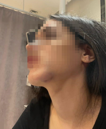 genc-kadini-olduresiye-darp-etti-beni-tuzaga-19290016_9923_m