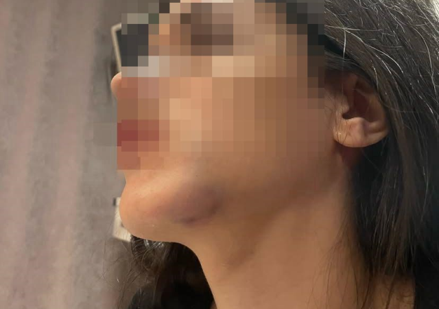 Eski sevgili dehşeti: Genç kadın tuzağa çekildiğini söyledi, darp fotoğraflarını paylaştı