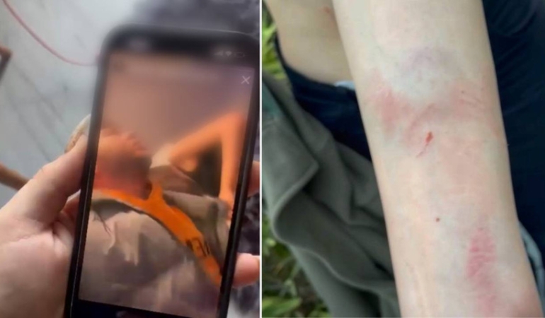 Antalya Büyükşehir Belediyesi çalışanına istismar suçlaması: 3 mağdur, 1 tanık